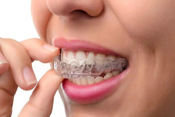 隐形牙箍的原理 隐形牙套的优点