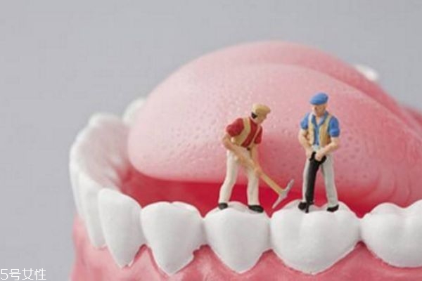 洗牙后怎么刷牙 洗牙对牙齿的好处