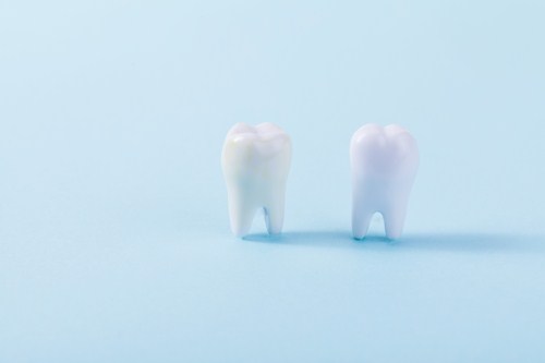 补牙洞要多长时间 补牙洞多少钱一颗