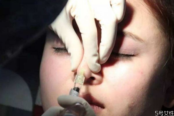 玻尿酸隆鼻后的注意事项 玻尿酸隆鼻后怎么护理