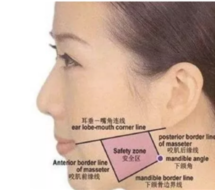 瘦脸针后多久可以化妆 瘦脸针后化妆会导致脸肿