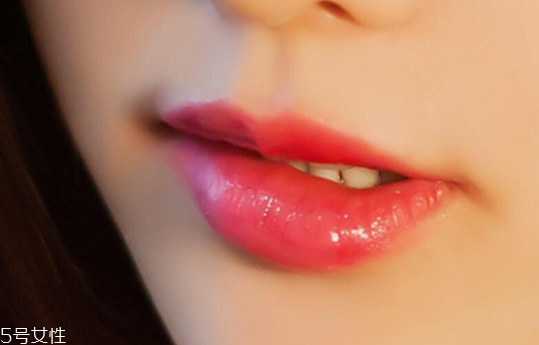 玻尿酸丰唇效果如何 玻尿酸丰唇后注意事项