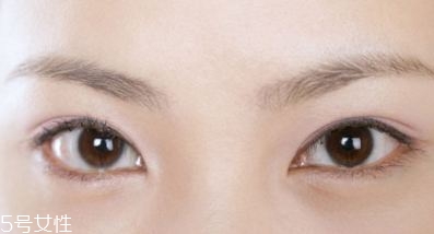 割双眼皮的术前准备有哪些？割双眼皮的常见做法