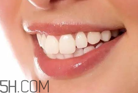 洗牙后牙缝变大是怎么回事？怎么保持牙齿洁白？