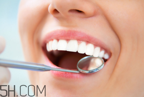 洗牙后牙缝变大是怎么回事？怎么保持牙齿洁白？