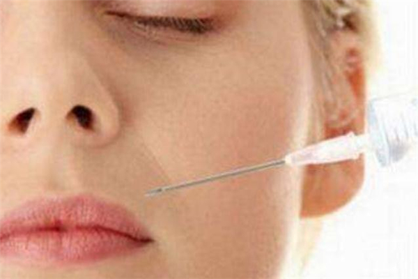 玻尿酸填充鼻唇沟能保持多久 玻尿酸丰鼻唇沟维持多久