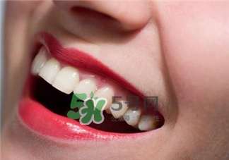 超声波洗牙的好处 超声波洗牙的副作用