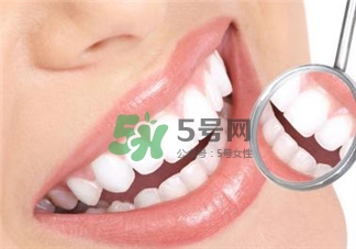 超声波洗牙的好处 超声波洗牙的副作用