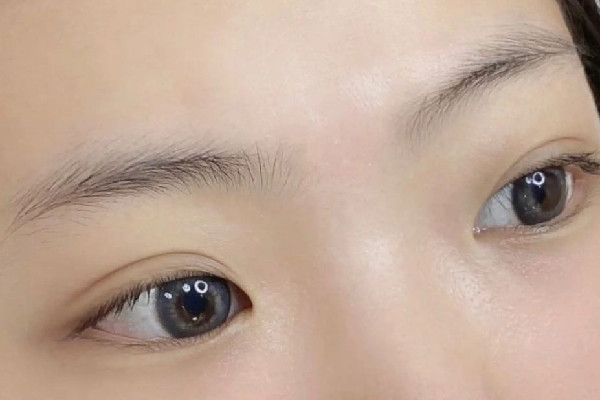 激光洗眉后色素沉着怎么去除 激光洗眉后可以涂生长因子吗