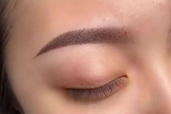 激光洗眉后的疤痕怎么修复 激光洗眉留疤是什么样的