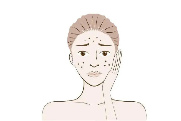 皮秒祛斑后多久可以洗脸 皮秒祛斑后洗脸能用洗面奶吗