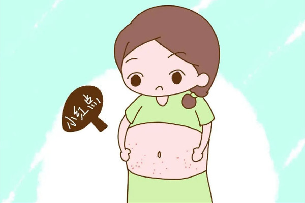 妊娠纹和肥胖纹是不是一样的 妊娠纹和肥胖纹的区别