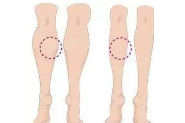 瘦腿针会影响月经吗 瘦腿针会导致瘫痪吗