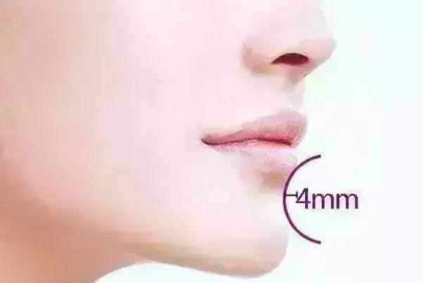 玻尿酸填充下巴有异物感多久消失 玻尿酸填充下巴有淤青如何快速消去