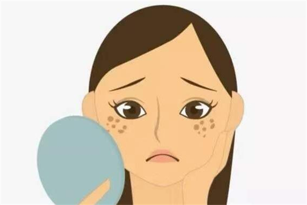激光祛斑可以洗脸吗 激光祛斑后怎么清理面部