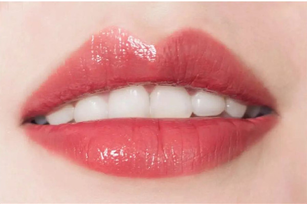 牙齿美白哪种方法好 牙齿美白有几种方式
