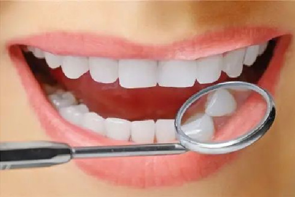 牙齿美白价格大概多少左右 牙齿美白去医院挂什么科