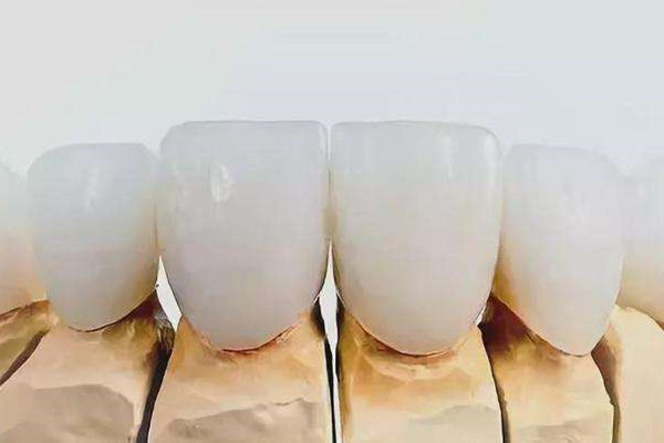 烤瓷牙会对原来的牙齿有影响吗 烤瓷牙的利弊