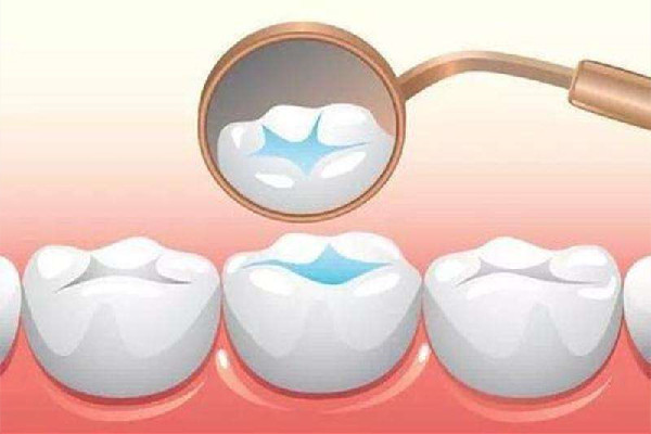 牙齿敏感会自己恢复吗 牙齿敏感去医院还是口腔医院