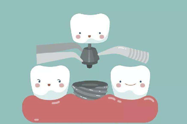 种牙可以用医保吗 种牙的好处与危害