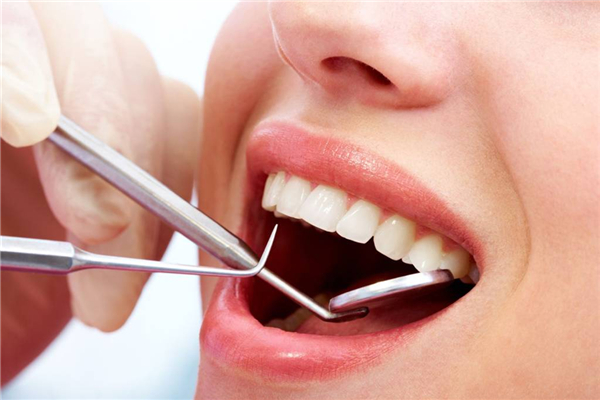 洗牙对牙齿有什么影响 洗牙可以除口臭吗