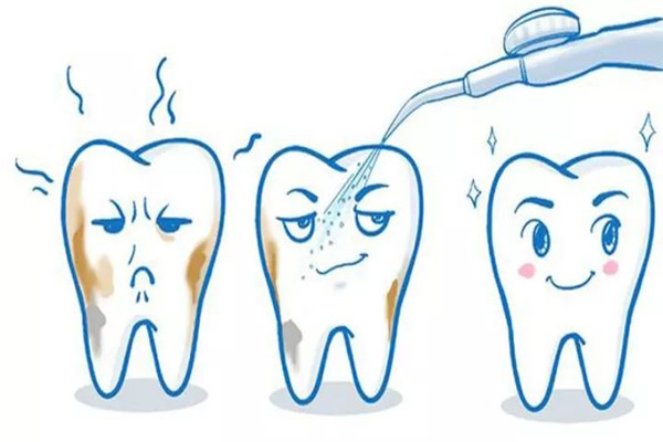 洗牙有哪些方法 洗牙有哪些流程