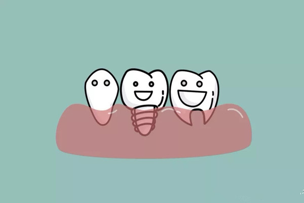 种植牙如何护理 种植牙会有后遗症吗