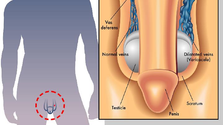 早萎阳泄是什么原因 男性早泄的症状